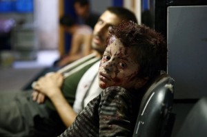 Syrian boy injured in Assad bombing (Abd Doumany:AFP:Getty Images) Sept 28 2015