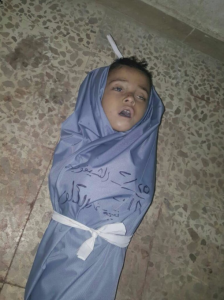 Chlorine gas victim in E. Ghouta (Mahmood Adam on Twitter) Feb 26 2018