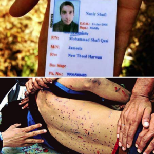 Kashmir pellet victim (Kashmir Conflict) Sept 18 2018
